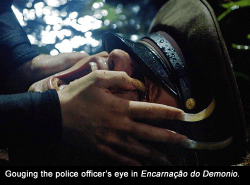 eye gouging